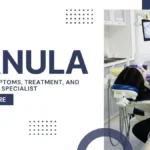 Ranula